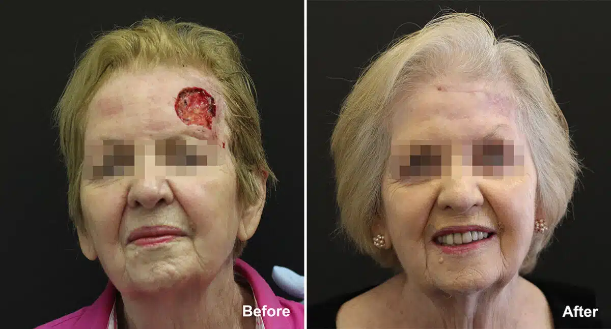 Reconstructive Surgery Before and After Photos in Princeton, NJ, Patient 1192