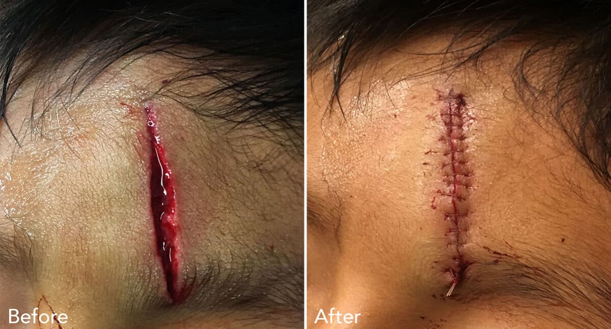 Reconstructive Surgery Before and After Photos in Philadelphia, PA, Patient 1285