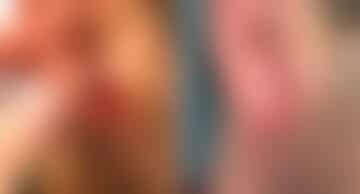 Reconstructive Surgery Before and After Photos in Philadelphia, PA, Patient 1293
