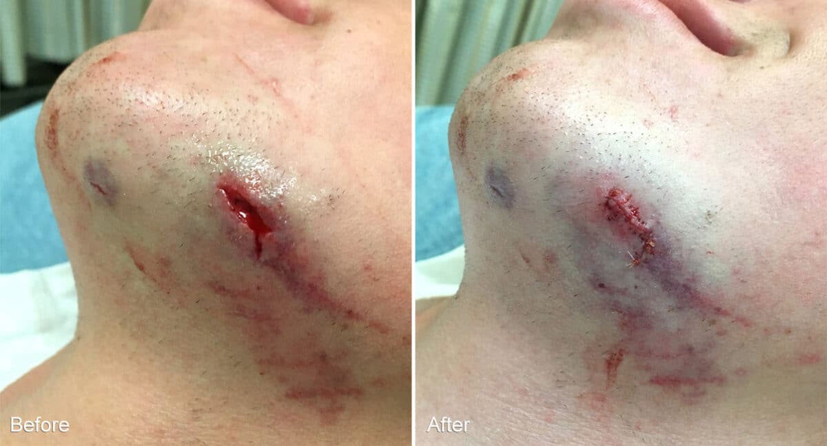 Reconstructive Surgery Before and After Photos in Philadelphia, PA, Patient 1317