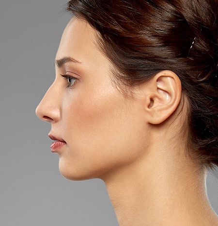 Functional Rhinoplasty 