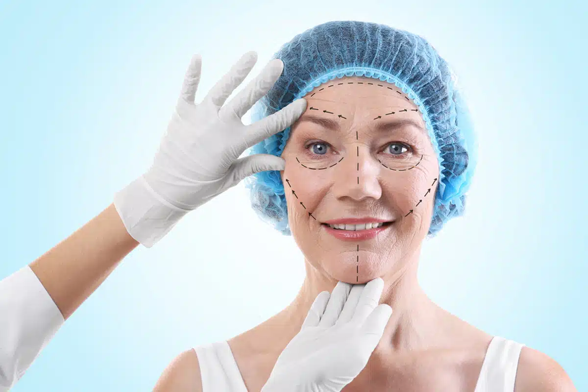 Is not common to have visible scars caused by a facelift. But if you have them, there are various treatments to get rid of them. 