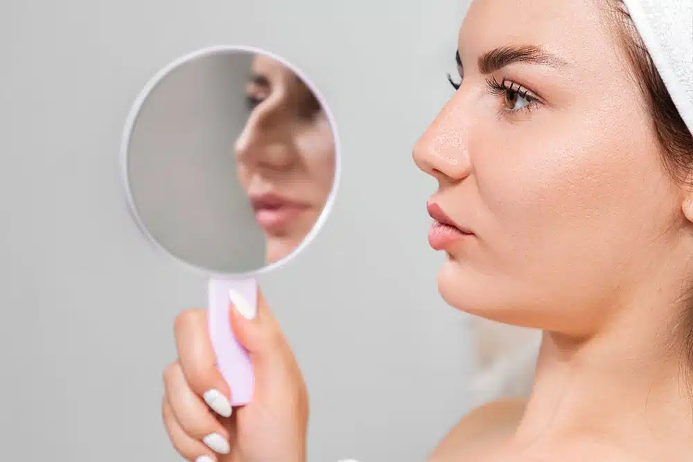The recovery from revision rhinoplasty can be longer than the initial surgery