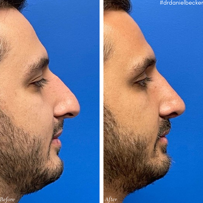 Before & After photos Dr. Becker