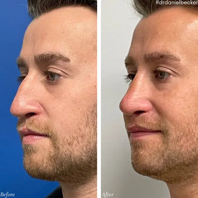 Before & After photos Dr. Becker