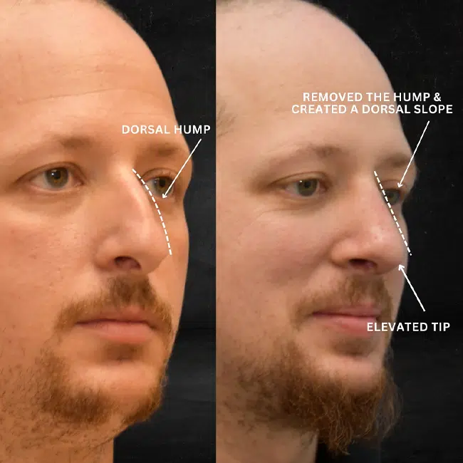 Before & After Photos Joanna Kam, MD