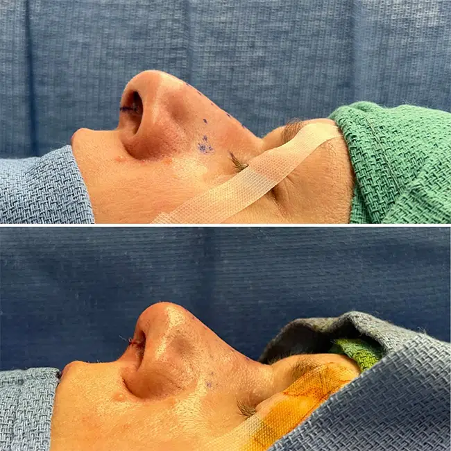 Before & After Photos Joanna Kam, MD