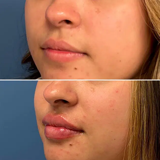 Before & After Photos Joanna Kam, MD