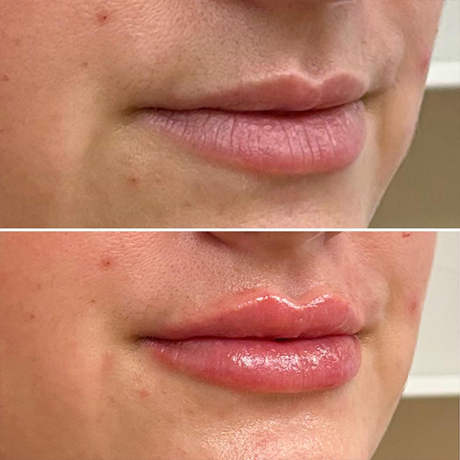 Before & After Photos Joanna Kam, MD