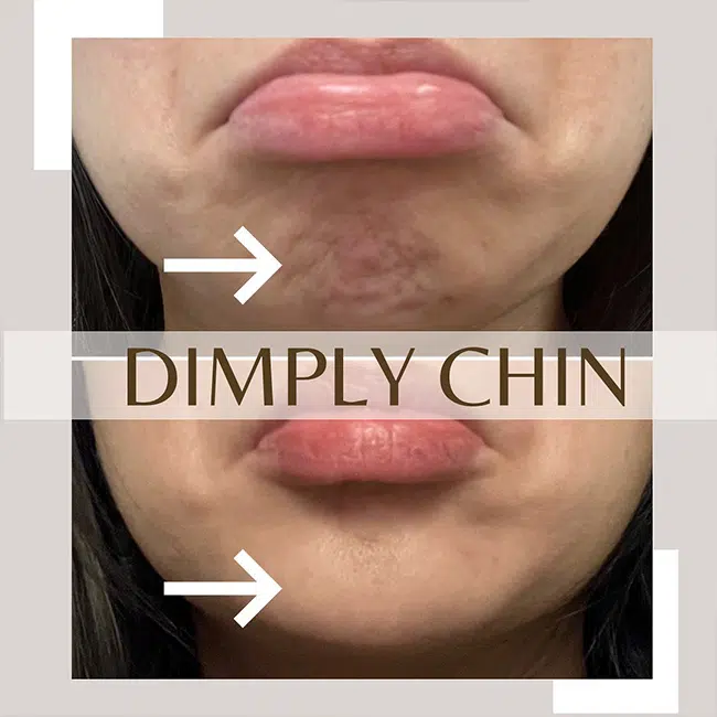 Before & After Photos Joanna Kam, MD