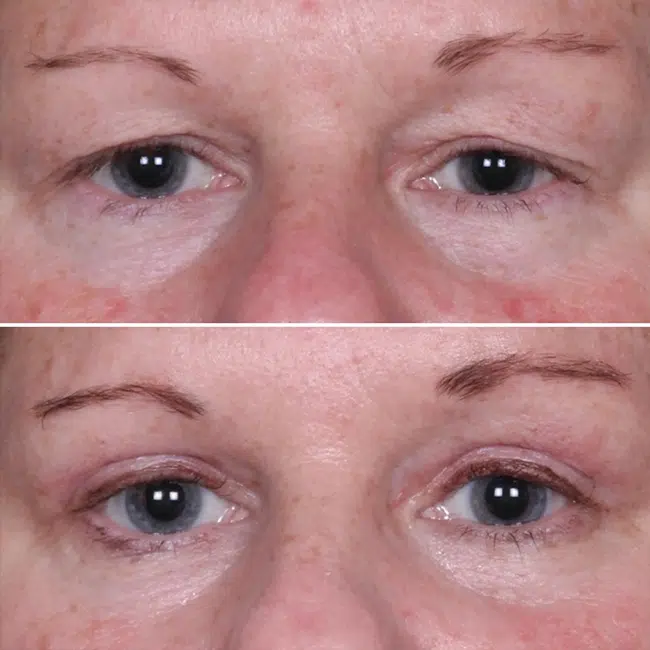 Before & After Photos Joanna Kam, MD