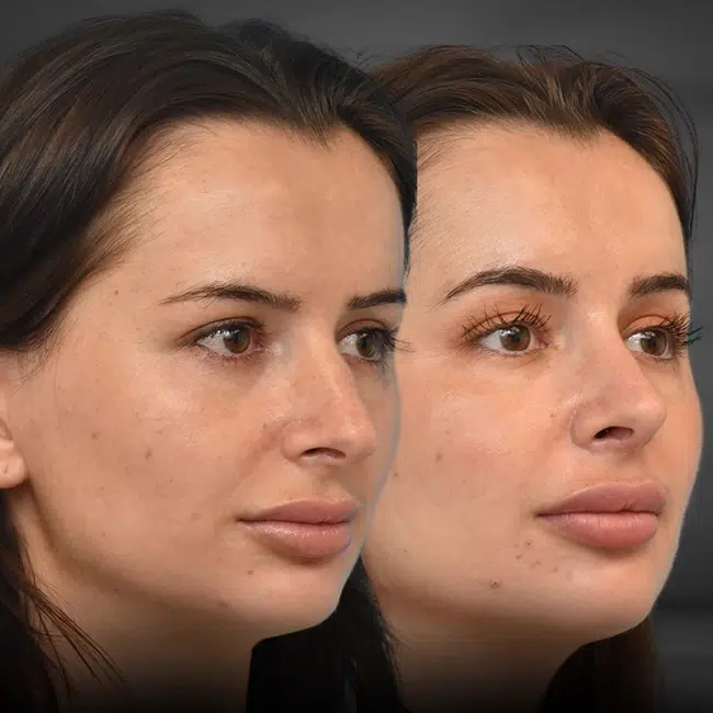 Before & After Photos Kirk Lozada, MD