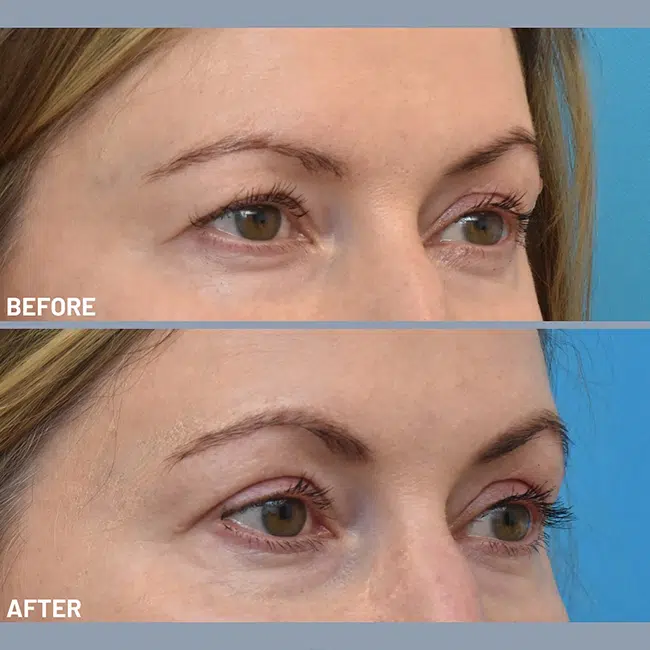 Before & After Photos Kirk Lozada, MD