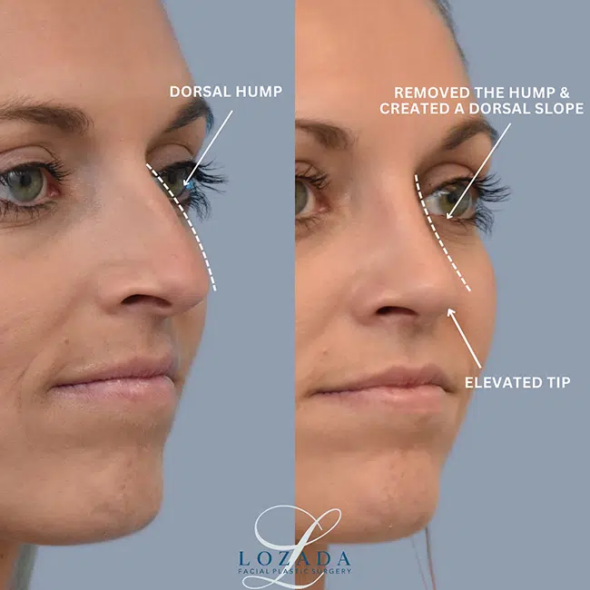 Before & After Photos Kirk Lozada, MD