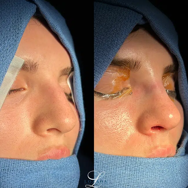 Before & After Photos Kirk Lozada, MD