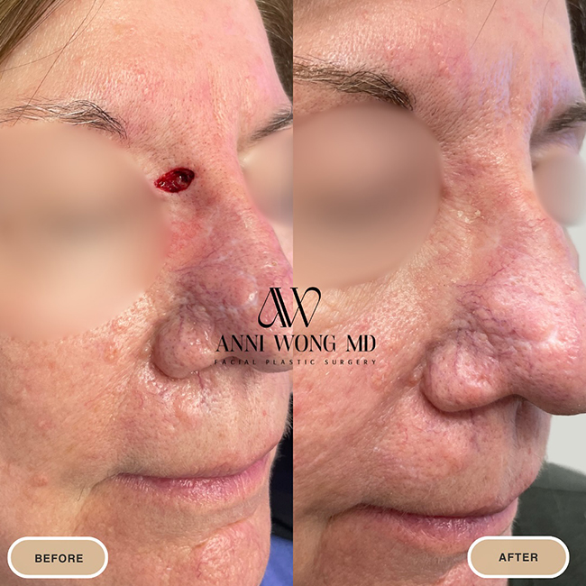 Before & After Photos Anni Wong, MD