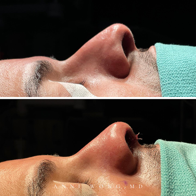 Before & After Photos Anni Wong, MD