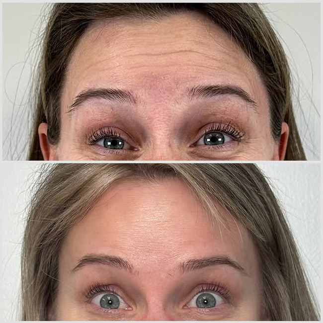 Before & After photos