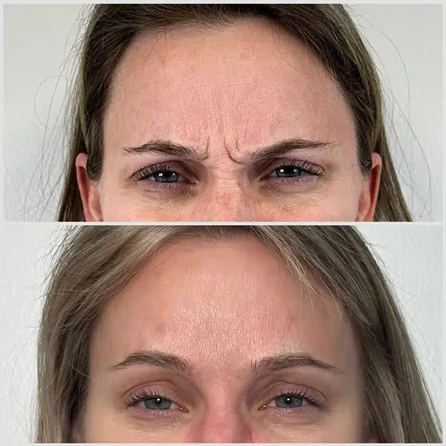 Before & After photos