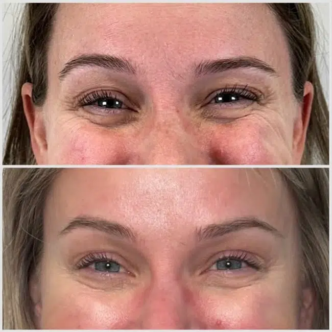 Before & After photos