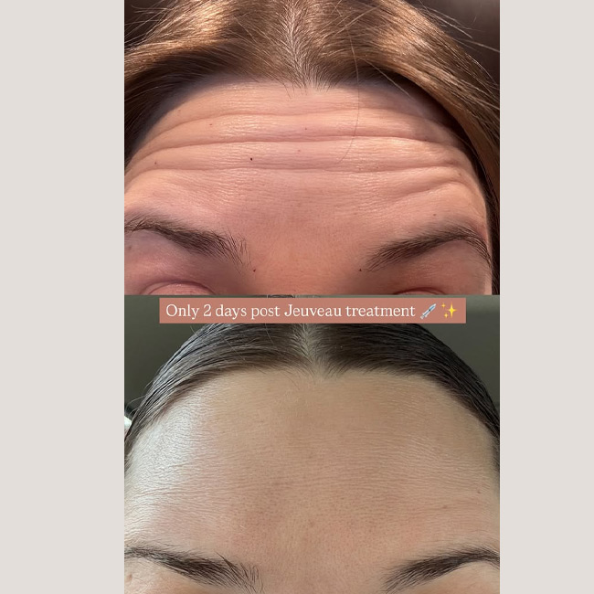 Before & After photos