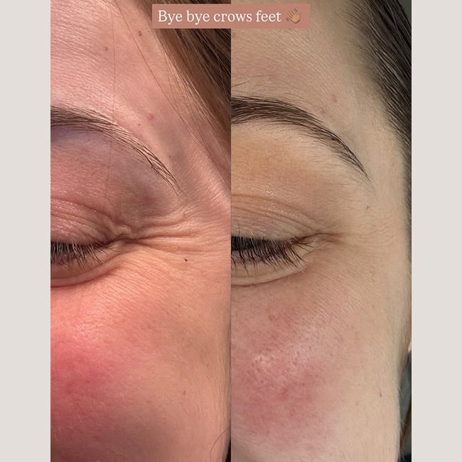 Before & After photos