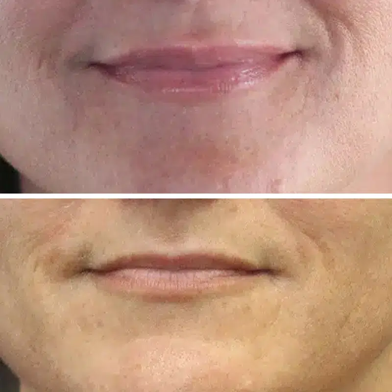 Before & After photos Dr. Becker
