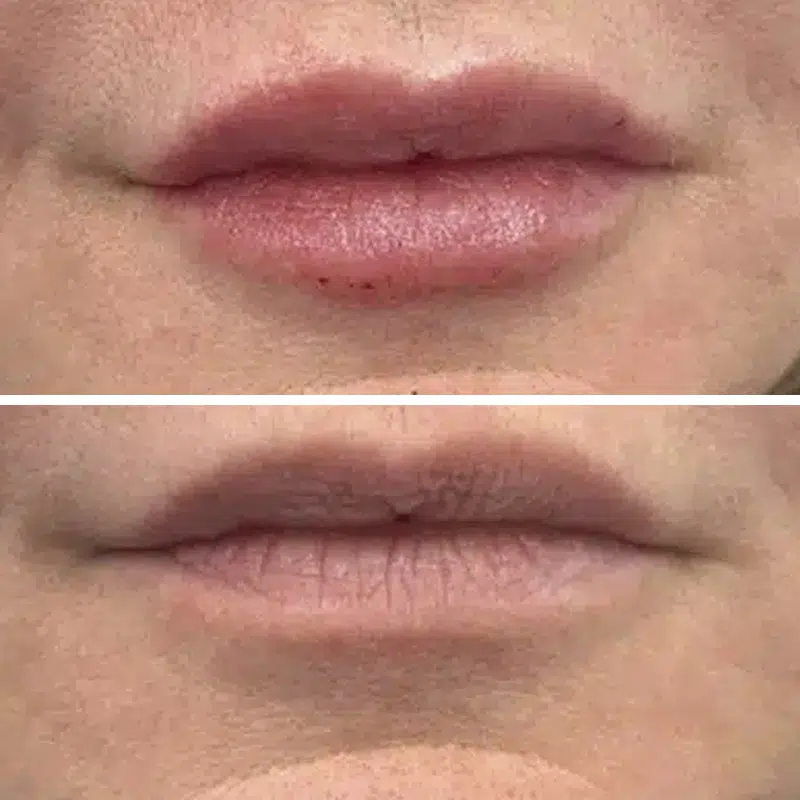 Before & After photos Dr. Becker