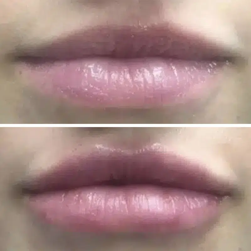 Before & After photos Dr. Becker