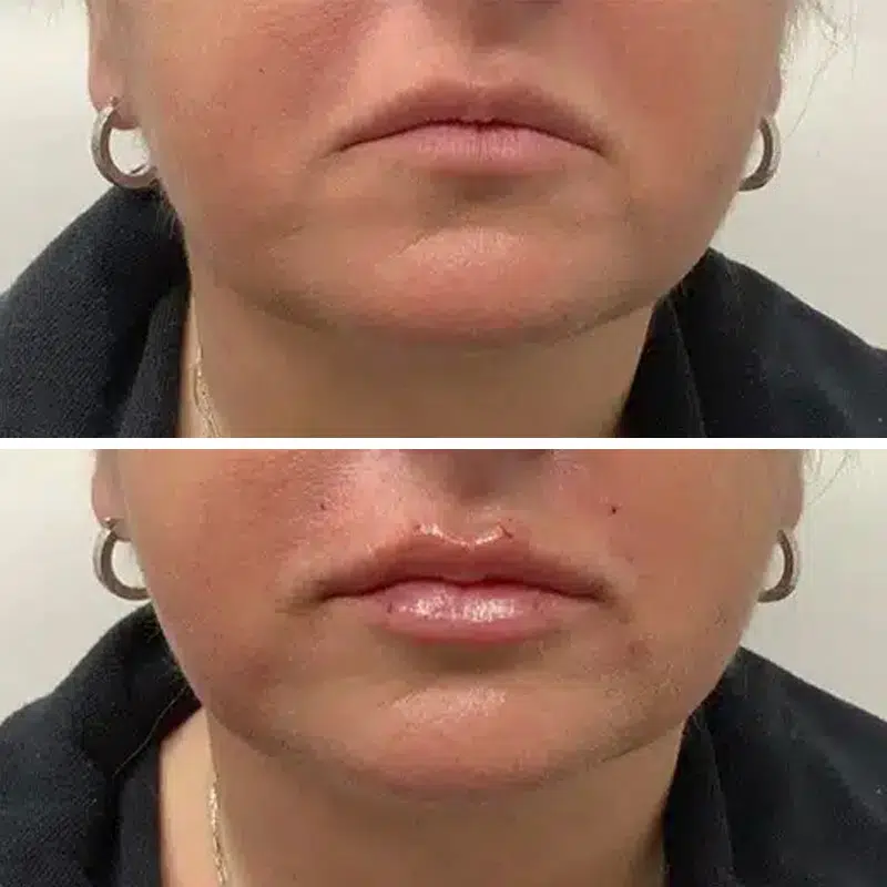 Before & After photos Dr. Becker