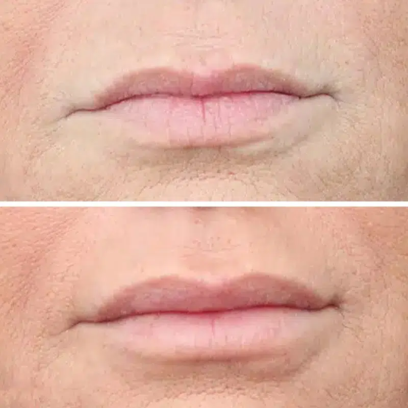 Before & After photos Dr. Becker