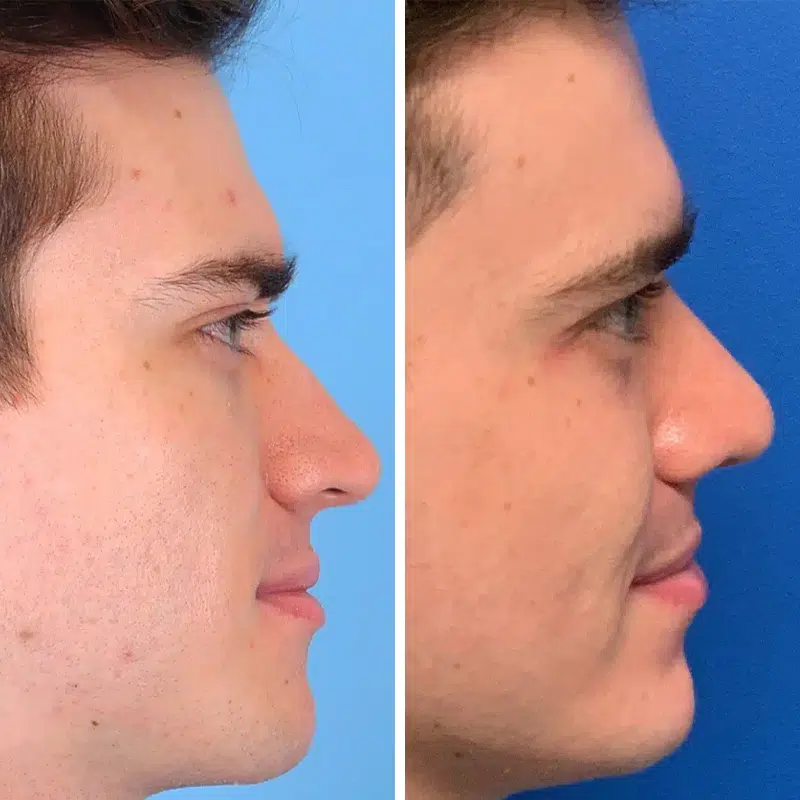 Before & After photos Dr. Becker