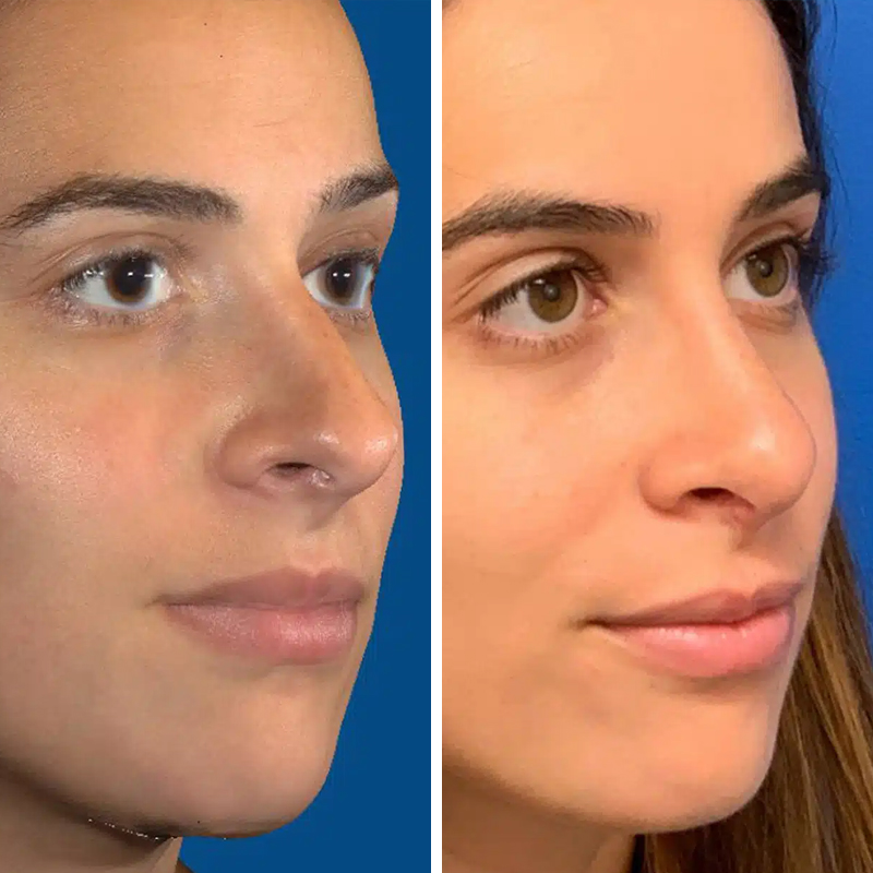 Before & After photos Dr. Becker