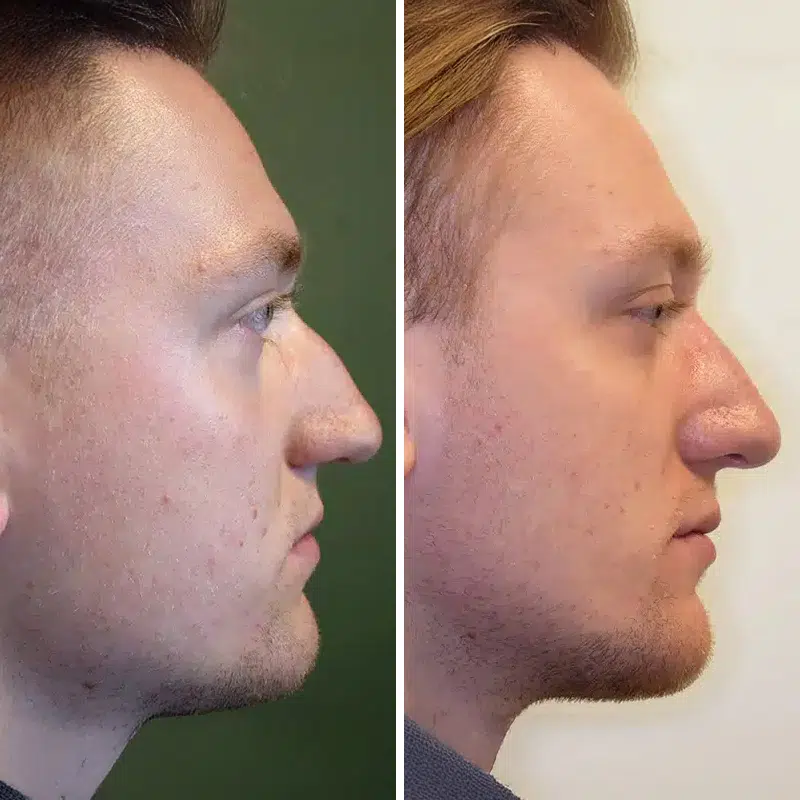 Before & After Photos Kirk Lozada, MD