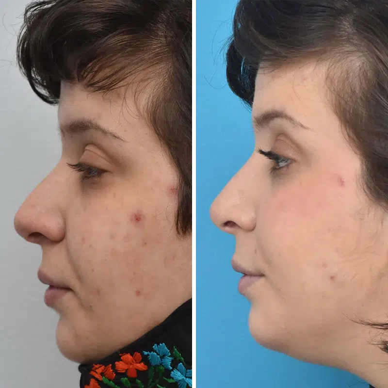 Before & After Photos Kirk Lozada, MD