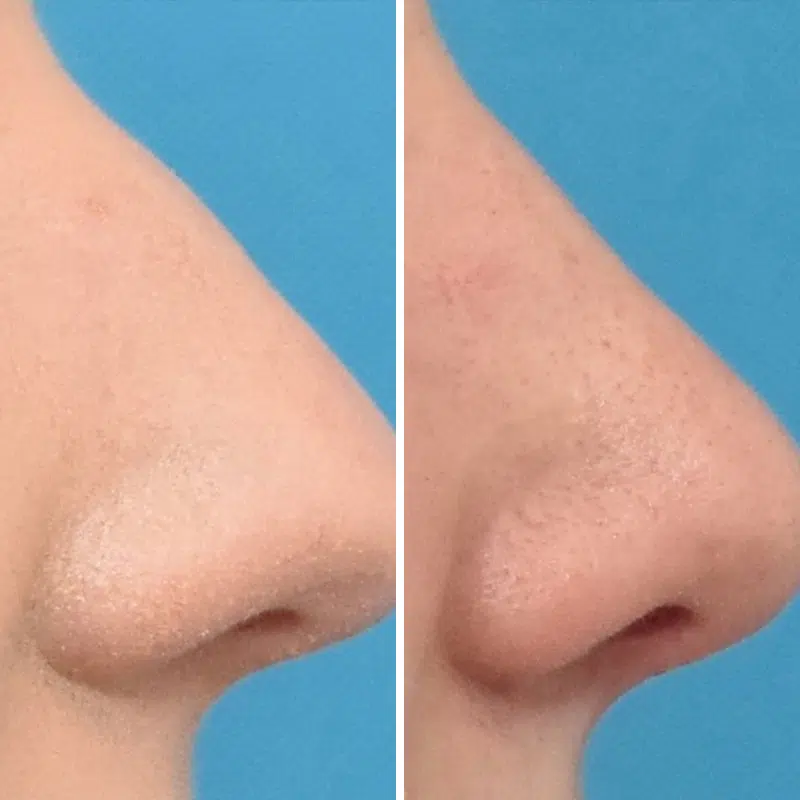 Before & After Photos Kirk Lozada, MD