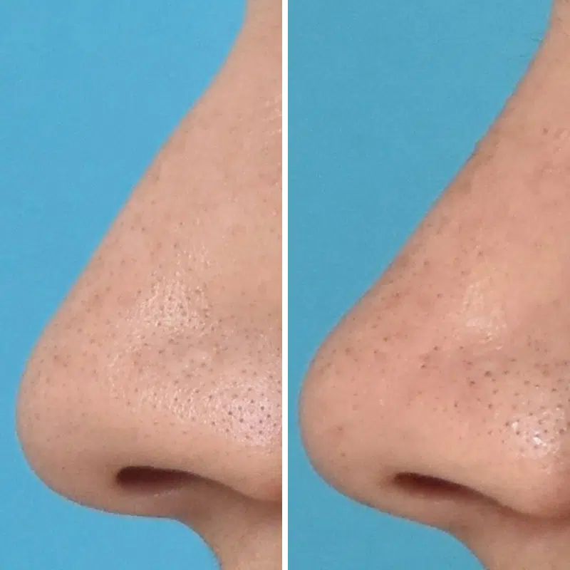 Before & After Photos Kirk Lozada, MD