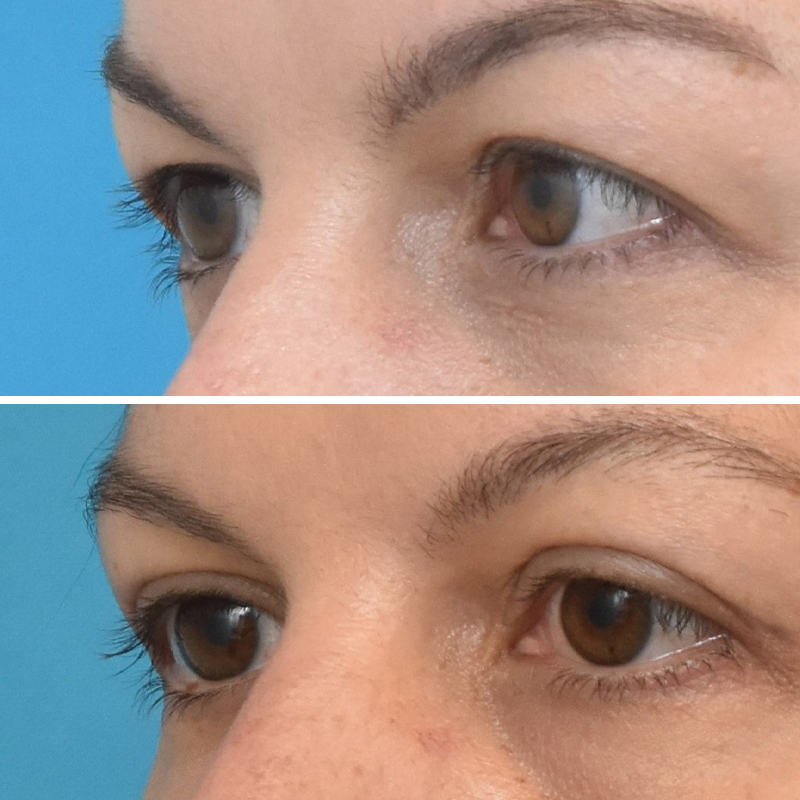 Before & After Photos Kirk Lozada, MD