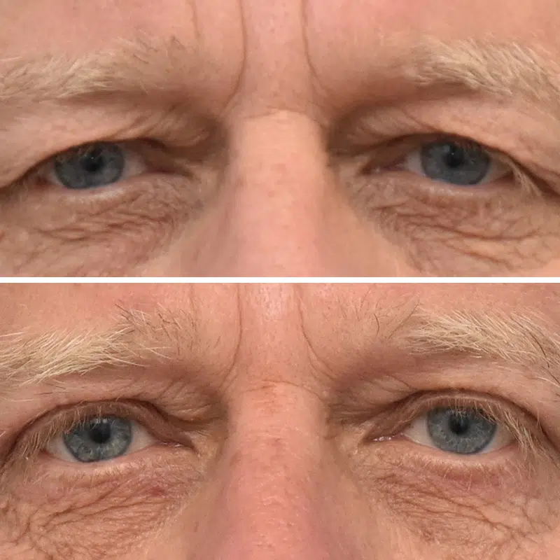 Before & After Photos Kirk Lozada, MD