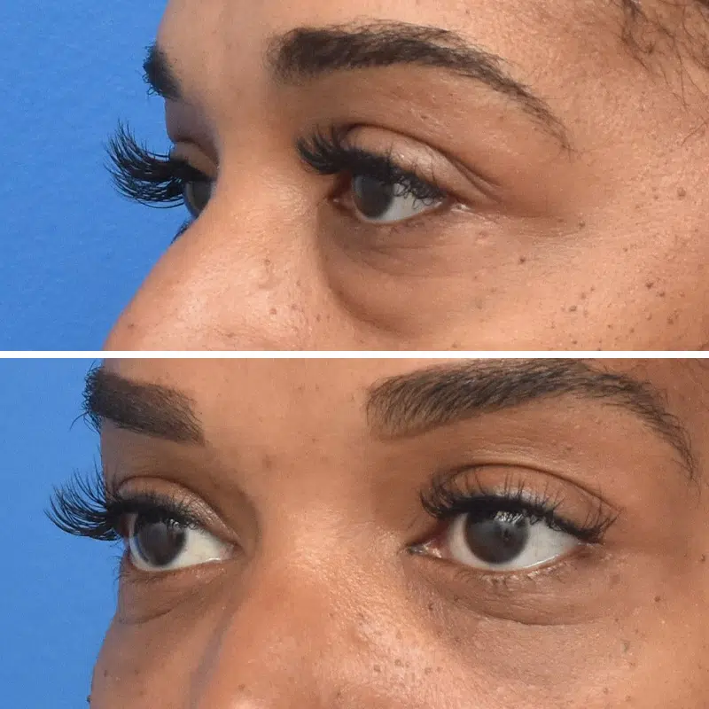 Before & After Photos Kirk Lozada, MD