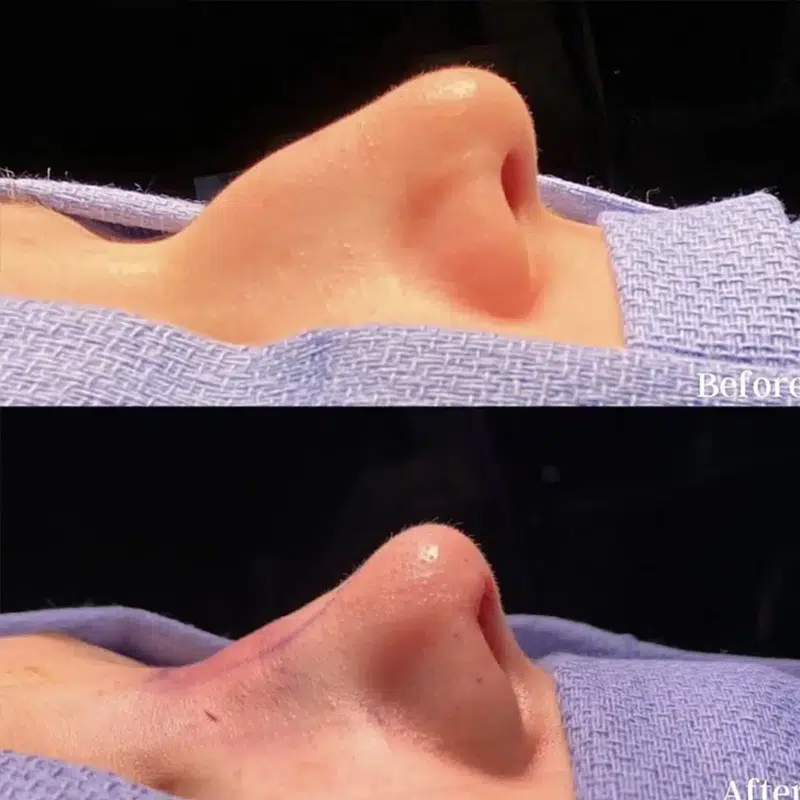 Before & After Photos Kirk Lozada, MD