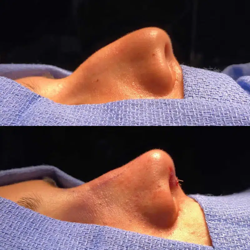 Before & After Photos Kirk Lozada, MD