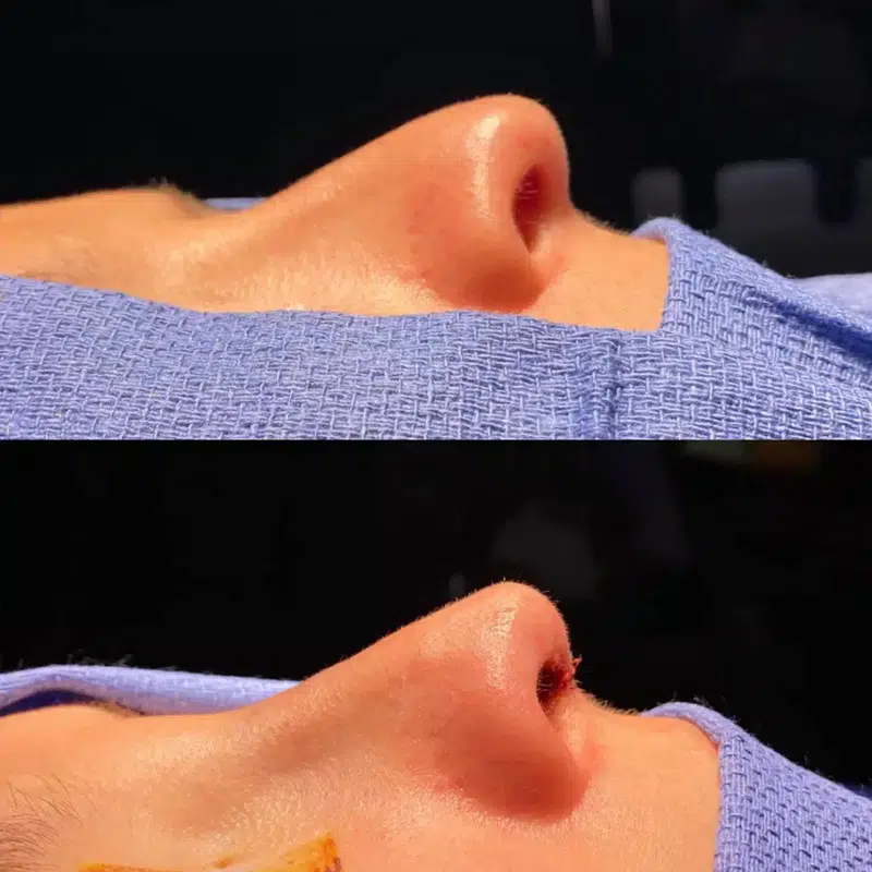 Before & After Photos Kirk Lozada, MD