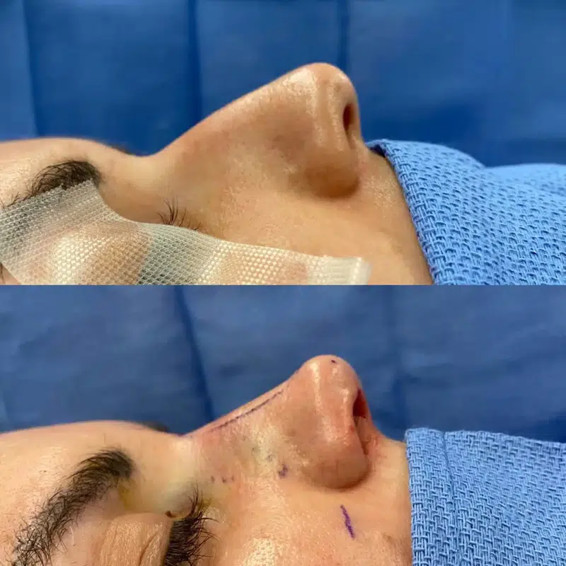 Before & After Photos Kirk Lozada, MD