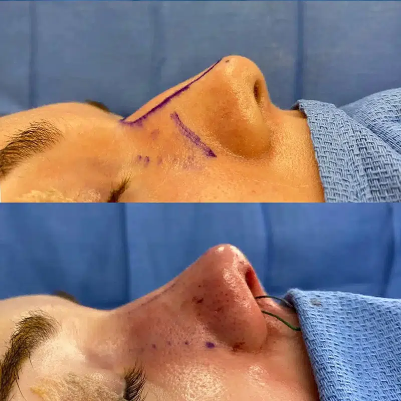 Before & After Photos Kirk Lozada, MD