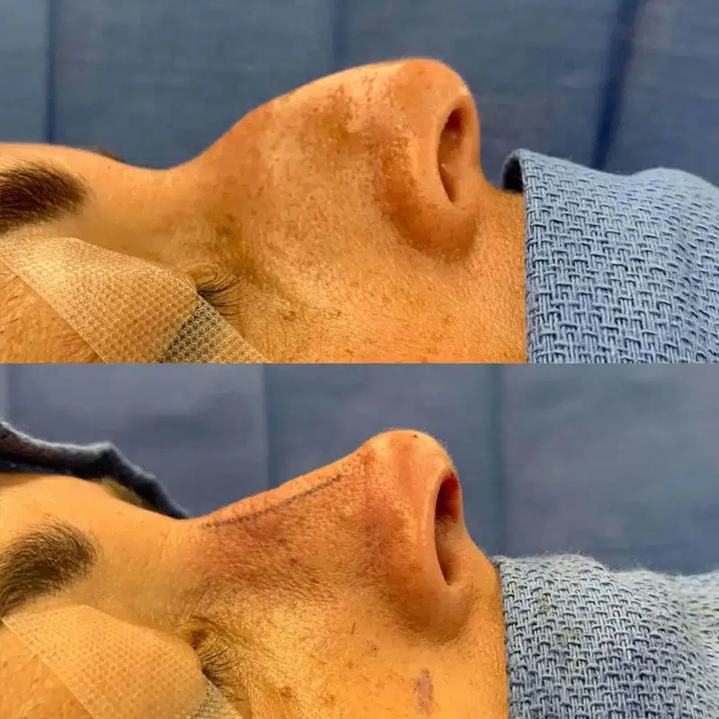 Before & After Photos Kirk Lozada, MD