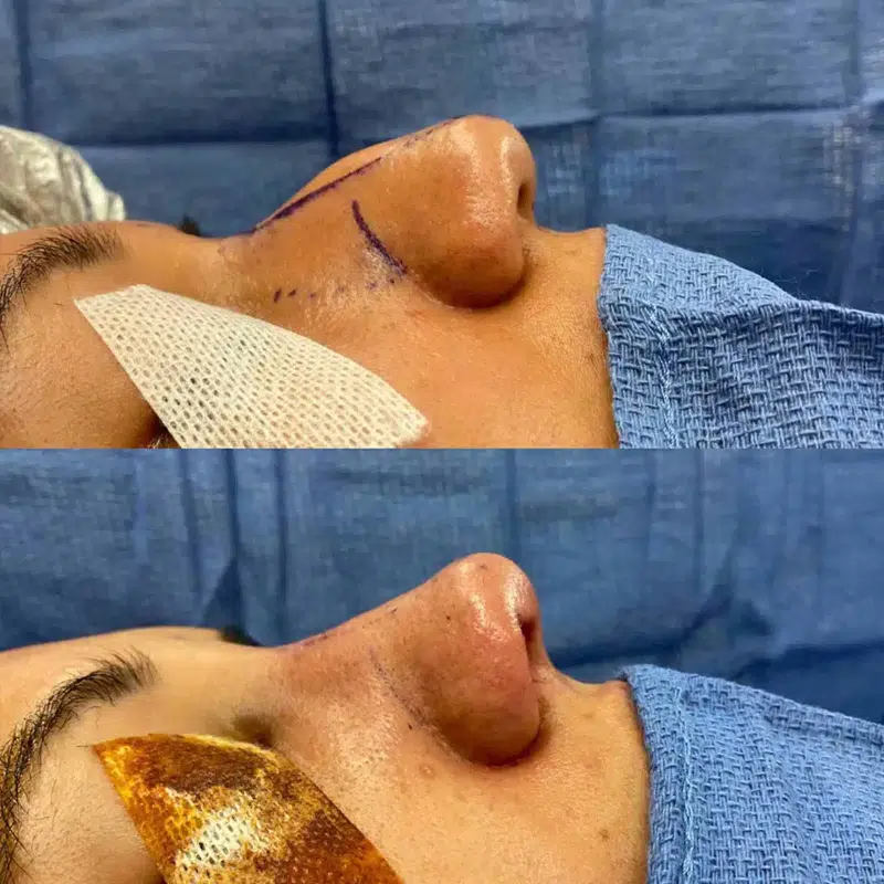 Before & After Photos Kirk Lozada, MD