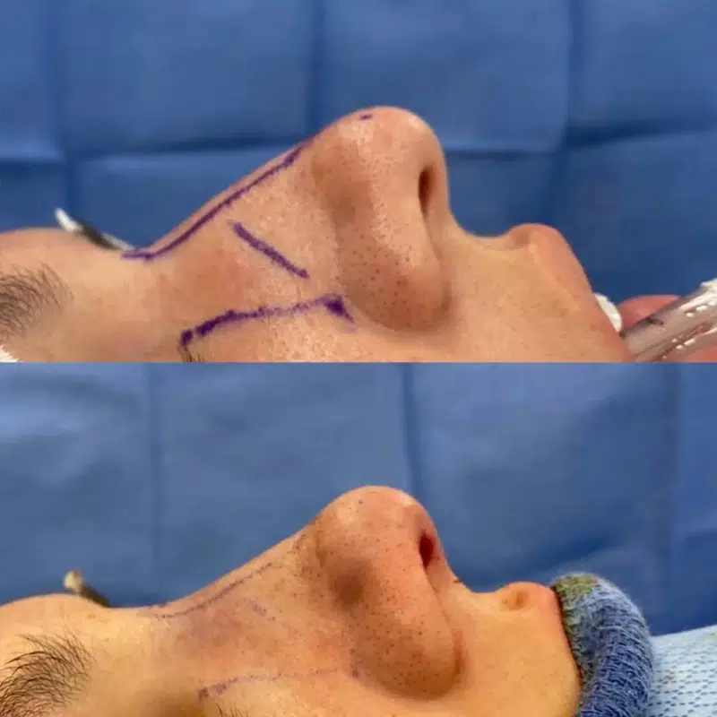 Before & After Photos Kirk Lozada, MD