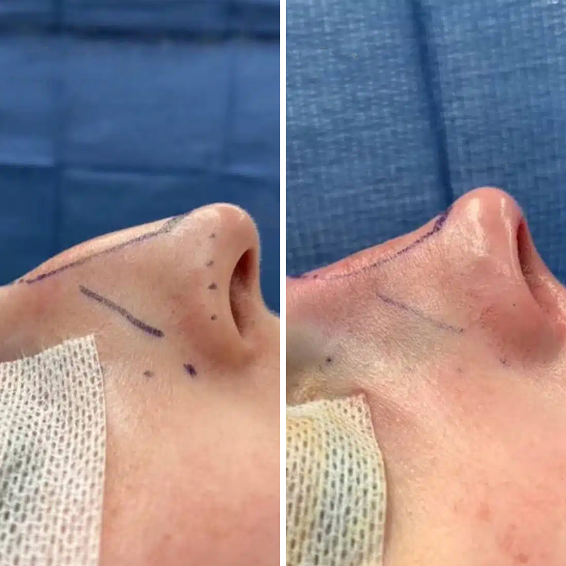 Before & After Photos Kirk Lozada, MD