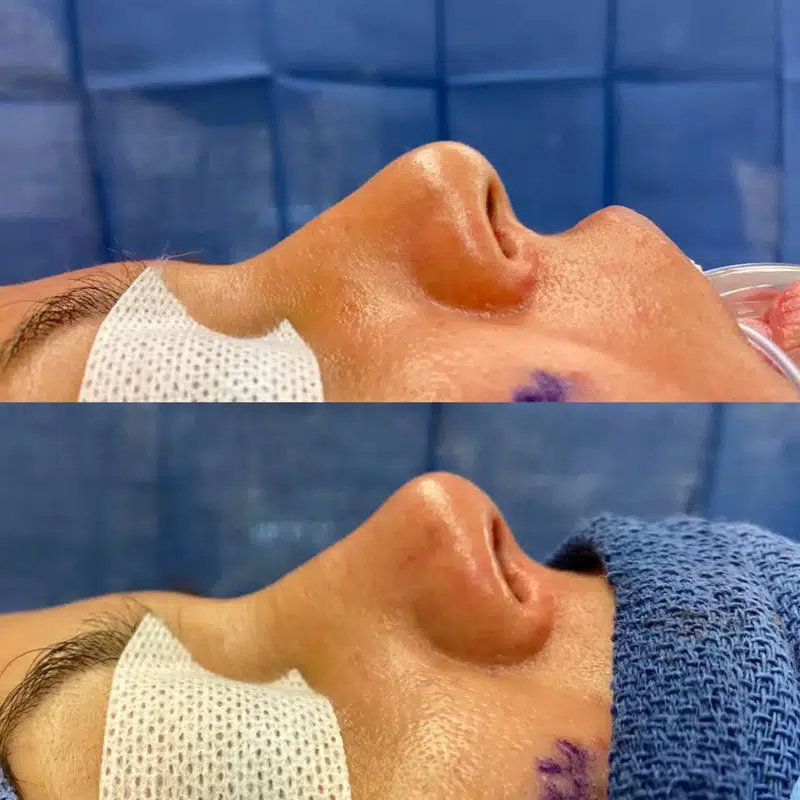 Before & After Photos Kirk Lozada, MD